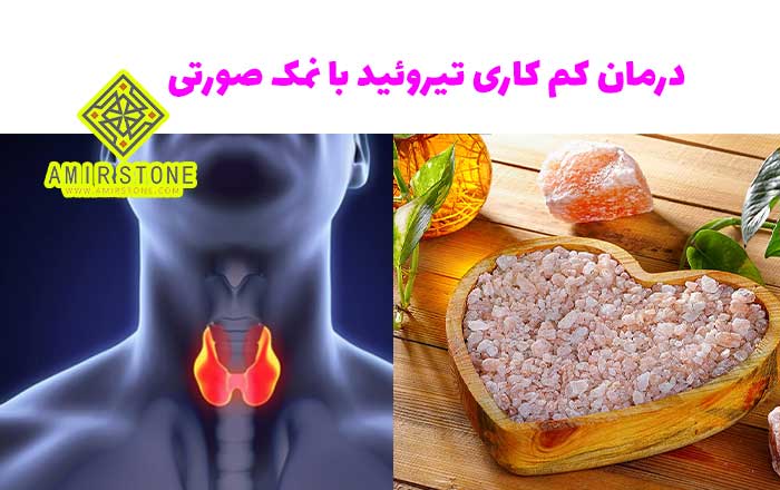 درمان کم کاری تیروئید با نمک صورتی | امیر استون